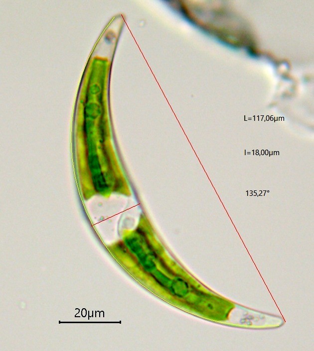 Closterium parvulum (15-Landeyrat)