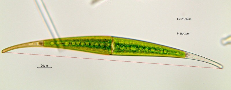 Closterium rostratum (15-Landeyrat)