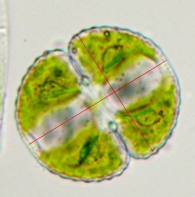 Cosmarium obtusatum (15-Dienne)