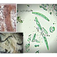 Spores fusiformes multiseptées de Graphis scripta