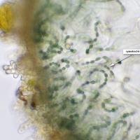Thalle de Leptogium hibernicum : cyanobactéries (longues chaines de Nostoc)