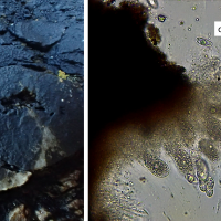 Périthèce de Hydropunctaria maura : l'ostiole