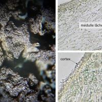 Thalle de Scytinium schraderi - cortex et médulle lâche