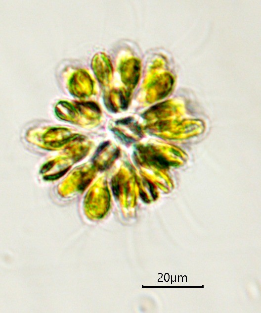 Synura sp. (63-Forêt de la Comté)