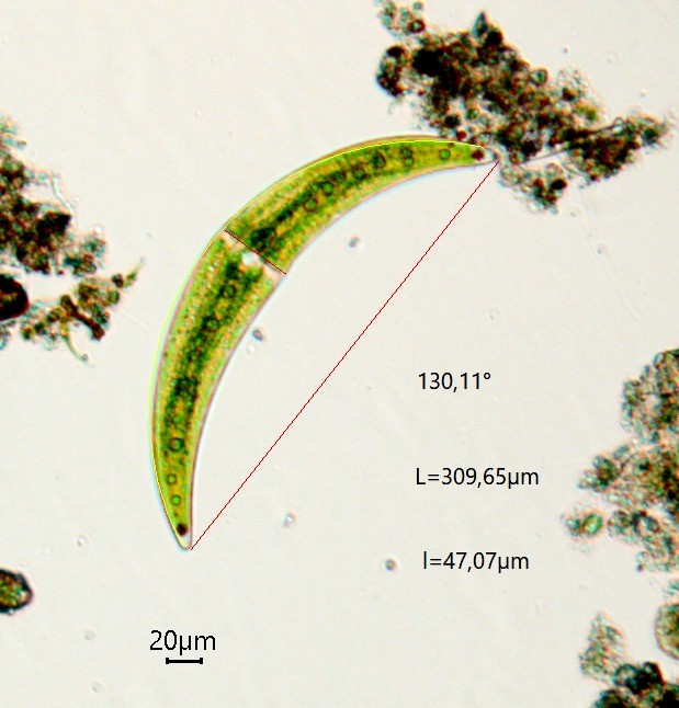 Closterium moniliferum (63-Forêt de la Comté)