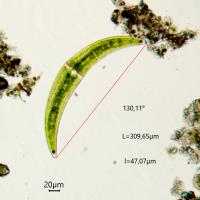 Closterium moniliferum (63-Forêt de la Comté)