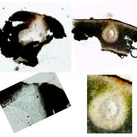 Périthèces de Verrucaria sp.et de Placidium sp.