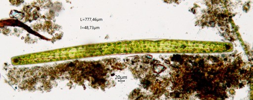 Pleurotaenium ehrenbergii  (63-Forêt de la Comté)