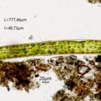 Pleurotaenium ehrenbergii  (63-Forêt de la Comté)