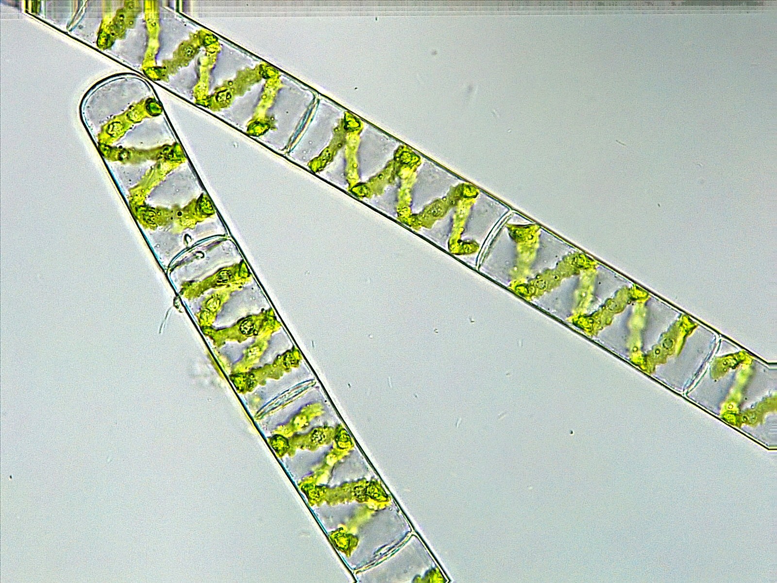 Spirogyra sp. (63-Forêt de la Comté)