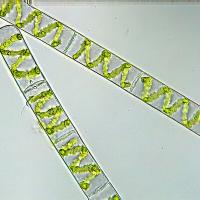 Spirogyra sp. (63-Forêt de la Comté)