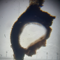 Périthèces de Thelidium papulare (2) : excipulum et involucrellum.